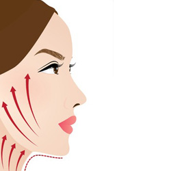 Jaw Reduction Surgery